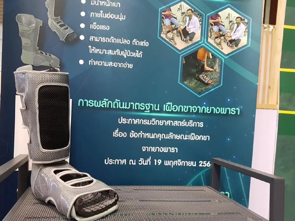 อว. ดัน "เฝือกขาจากยางพารา" ขึ้นบัญชีนวัตกรรมไทยสำเร็จ