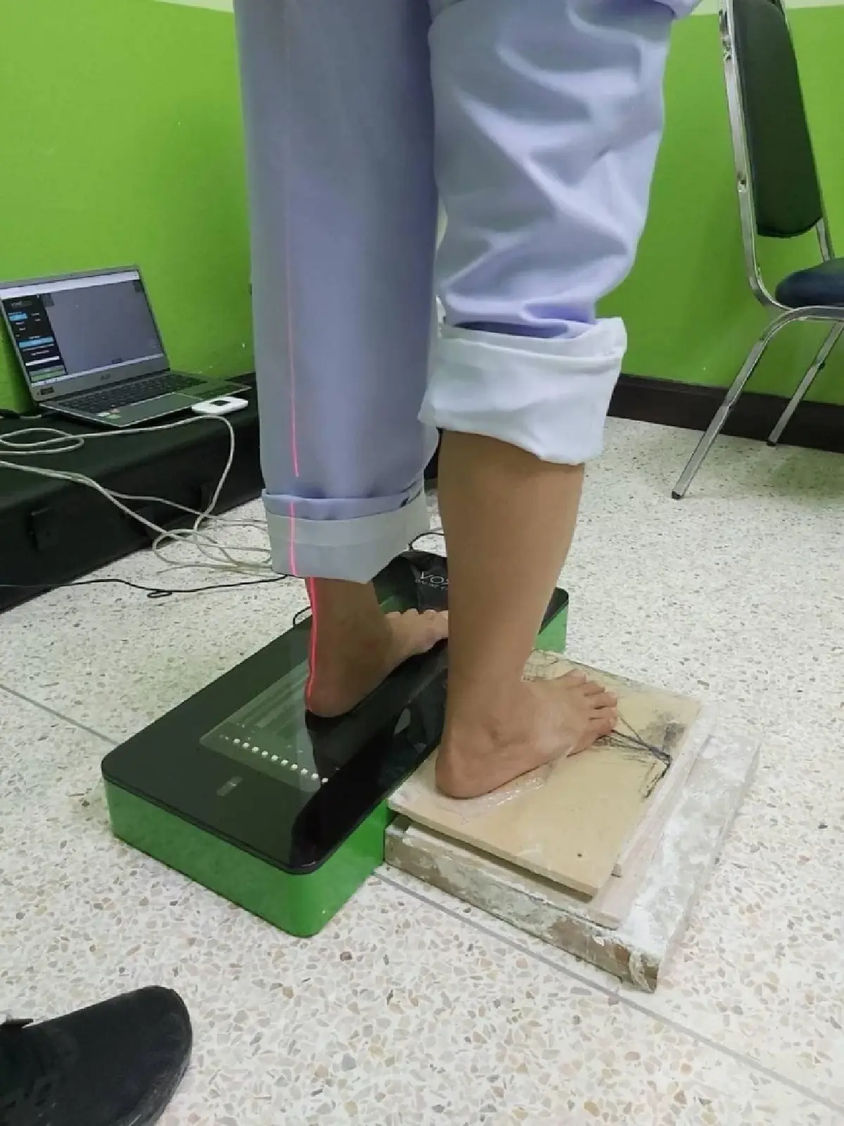 “แผ่นรองฝ่าเท้าสุขภาพ” นวัตกรรมไทย ช่วยผู้ป่วยเบาหวาน