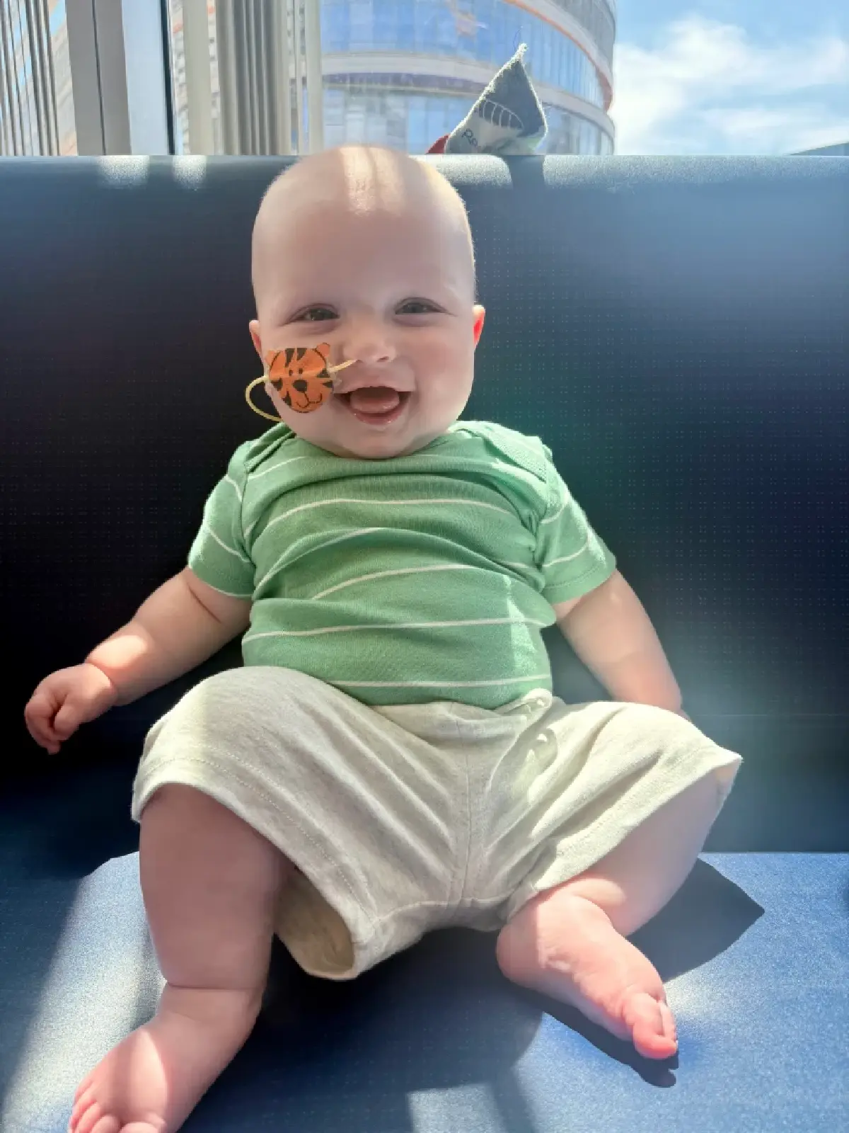 หนูน้อยเคเจ หลังจากได้รับการรักษาเป็นครั้งที่ 3 ในเดือนเมษายนที่ผ่านมา