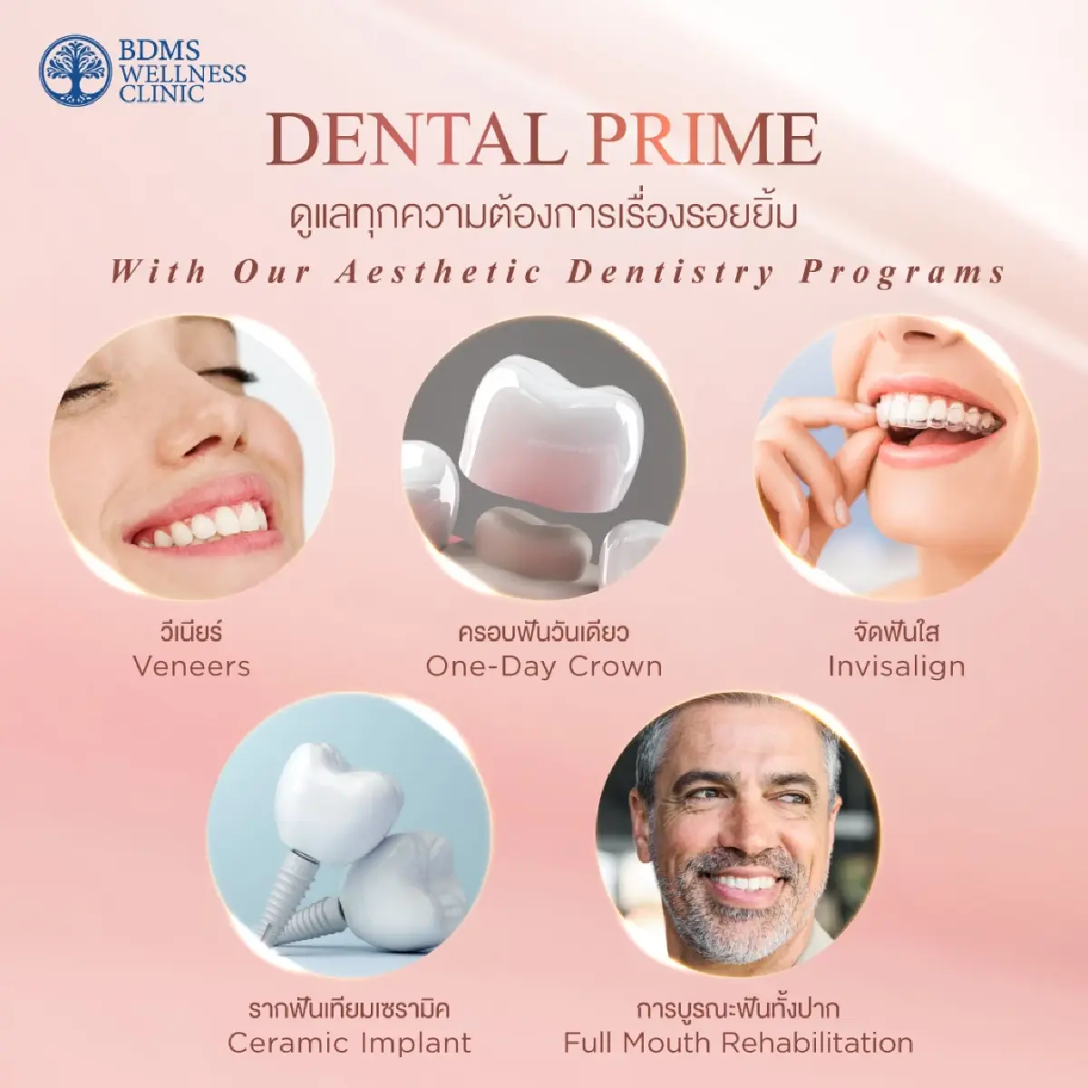 BDMS Wellness Clinic เปิดตัว Dental Prime ดูแลสุขภาพช่องปากครบวงจรลักชัวรี