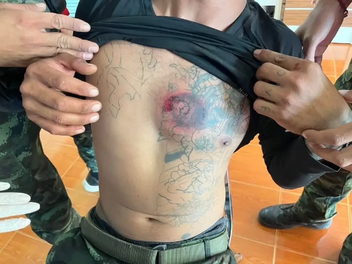 ทบ. ชี้หลักฐานชัด กัมพูชาเปิดฉากยิง ทำทหารไทยเจ็บ 2 นายในเขตไทย