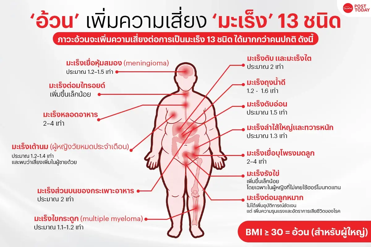 กางตัวเลข "อ้วน" เพิ่มโอกาสเสี่ยง "มะเร็ง" 13 ชนิด!
