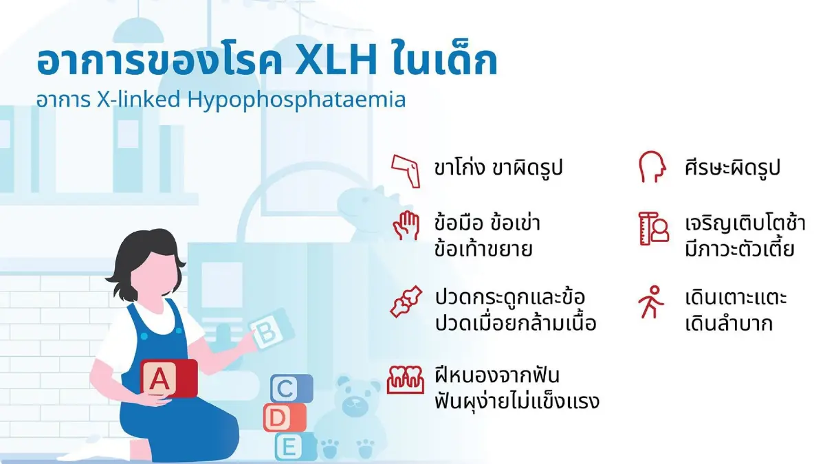 ปี 69 มาแน่! ยาเม็ดฟอสเฟต ความหวังใหม่ผู้ป่วย 'โรคกระดูกอ่อน XLH'