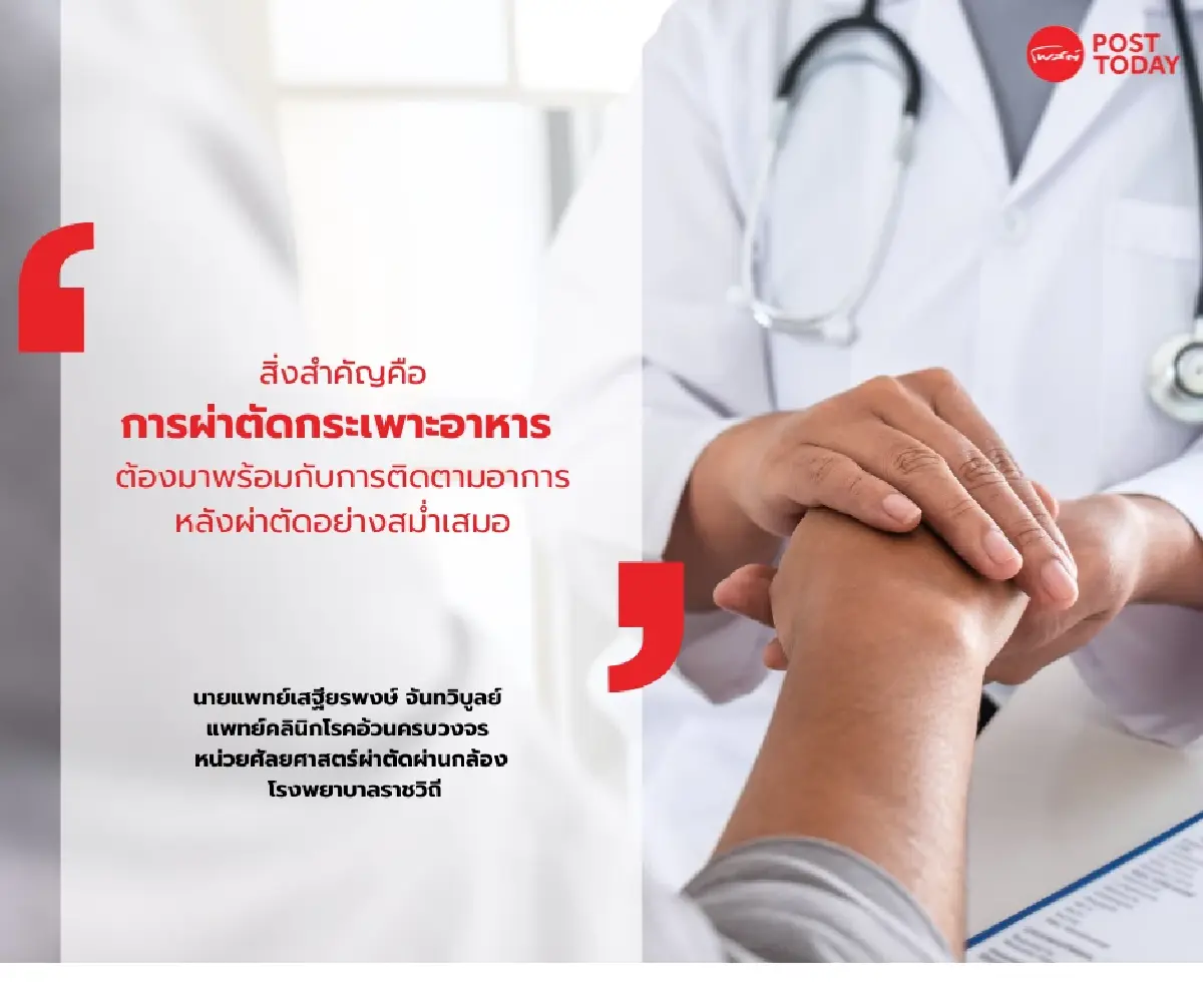 “ผ่าตัดกระเพาะ” คือ มาตรฐานการรักษา “โรคอ้วน” ตอบ! ส่งผลต่อสุขภาพจิต?