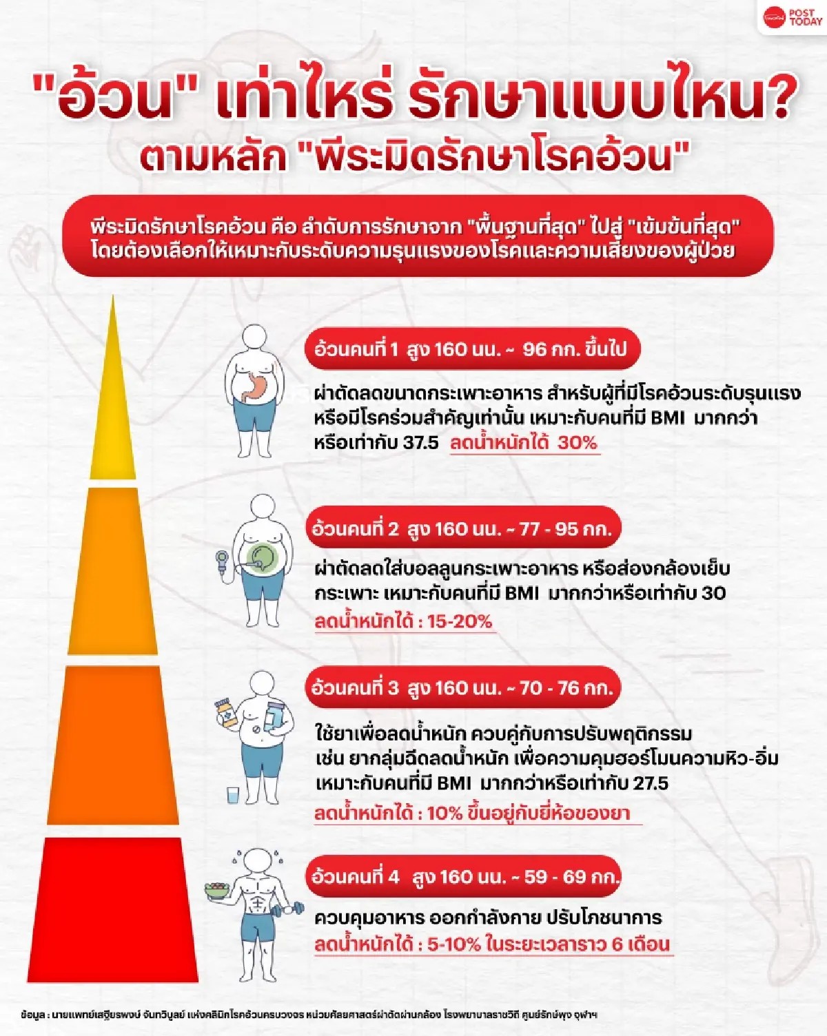 ผ่าตัดกระเพาะอันตรายหรือไม่? ทั้งที่เป็นมาตรฐานการรักษา “โรคอ้วน” และส่งผลต่อสุขภาพจิต?