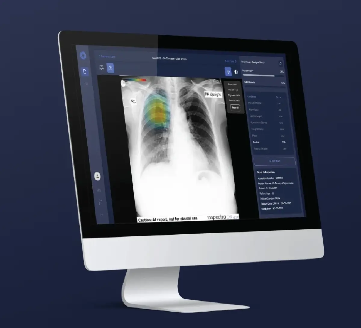 จากลูกคุณหมอสู่ผู้ปั้น AI สตาร์ทอัพ Medical Tech โตทะลุ 100 ล้าน