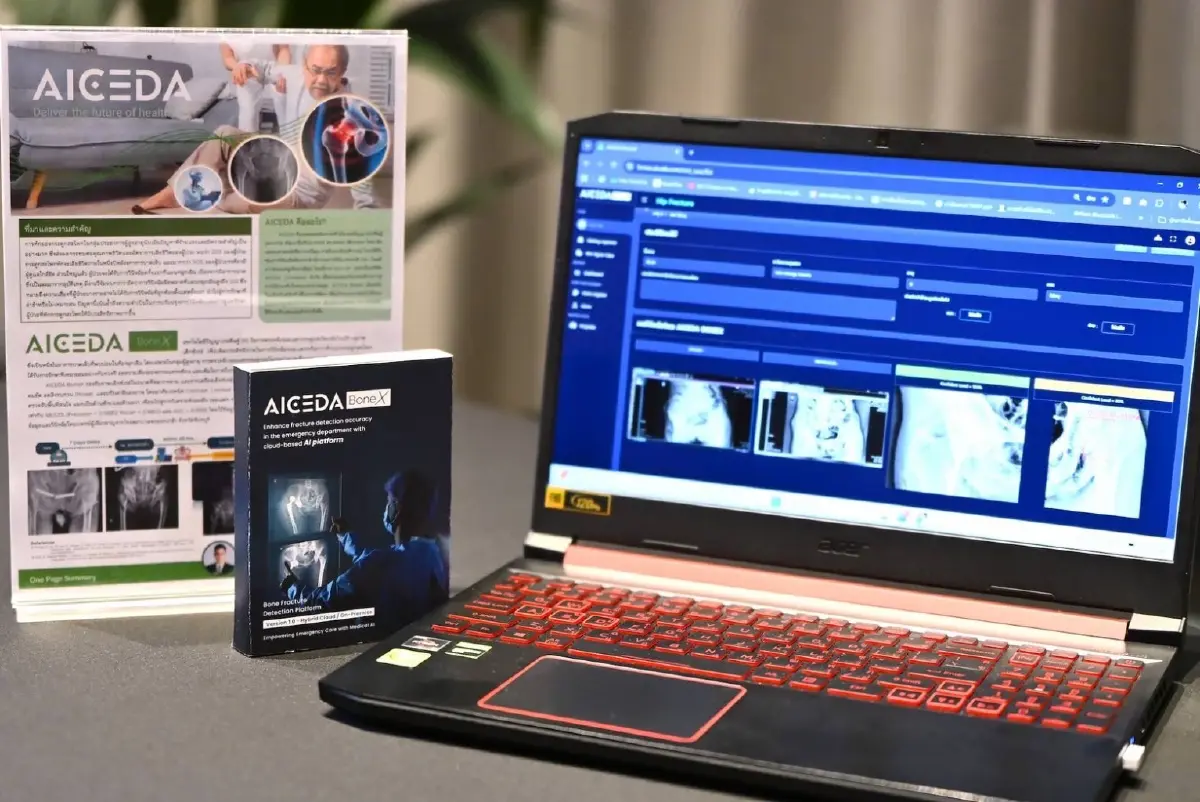 SPEAR H Accelerator แพลตฟอร์มผลิตเฮลธ์เทคสตาร์ทอัพ ป้อนตลาดแพทย์