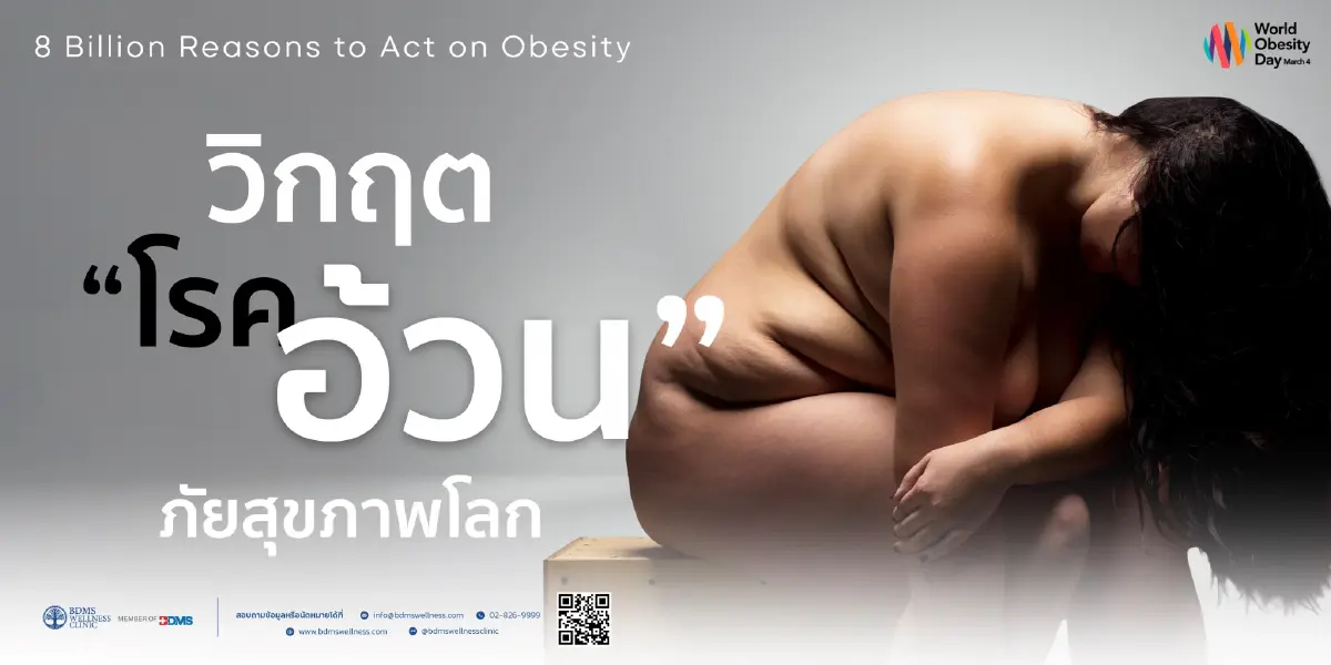 หมอแอมป์เตือนวิกฤตโรคอ้วนพันล้านคนทั่วโลก จี้ปฏิรูปเชิงระบบรับวันอ้วนโลก