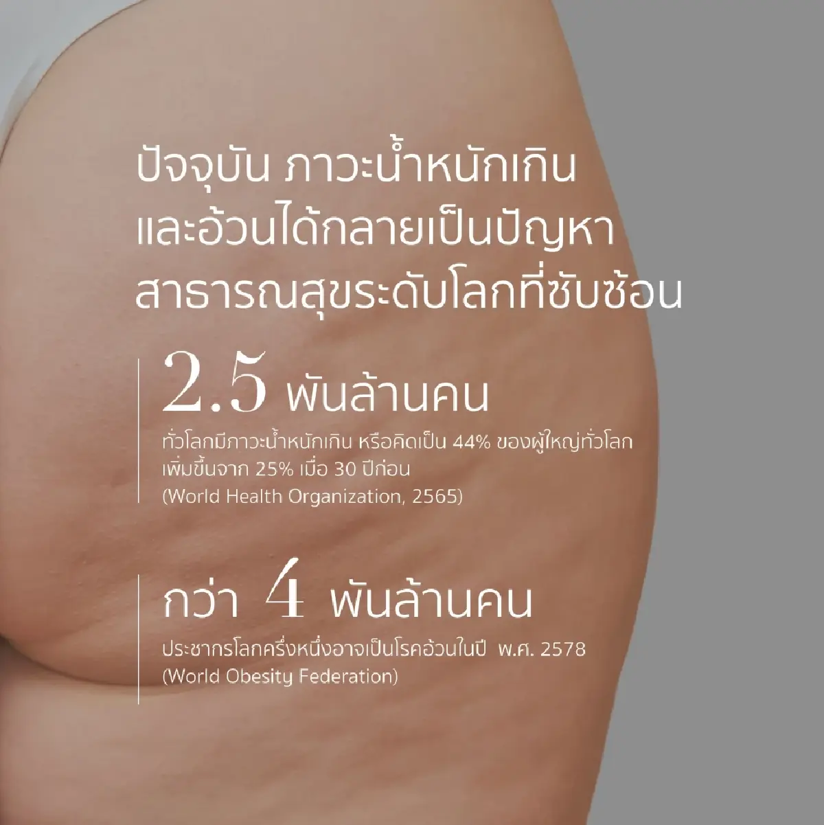 หมอแอมป์เตือนวิกฤตโรคอ้วนพันล้านคนทั่วโลก จี้ปฏิรูปเชิงระบบรับวันอ้วนโลก