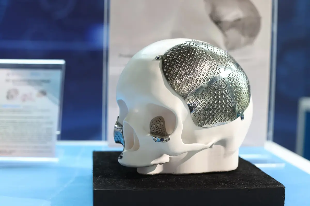 กางแผนปี 70-71 "สปสช." หนุนนวัตกรรมไทยเพิ่ม 5 เท่า! งบกว่า 1.5 หมื่นล้าน