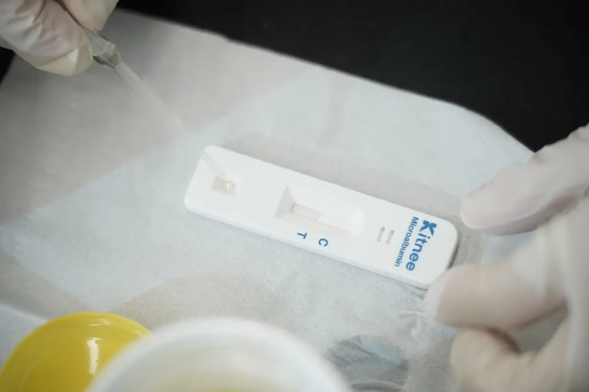 คนไทยเสี่ยงโรคไตกว่า 10 ล้านราย สมาคมโรคไตฯ แนะคัดกรองไวช่วยได้