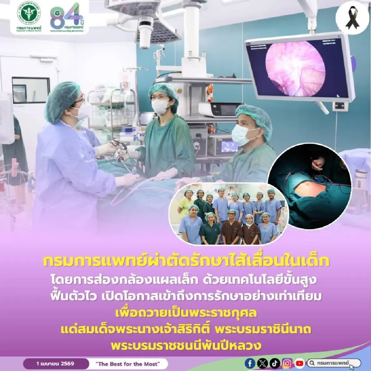 กรมการแพทย์โชว์นวัตกรรม "ผ่าตัดไส้เลื่อนเด็กส่องกล้องแผลเล็ก" ฟื้นตัวไว-ปลอดภัยสูง เดินหน้าขยายโอกาสการรักษาที่เท่าเทียมเพื่อถวายเป็นพระราชกุศล