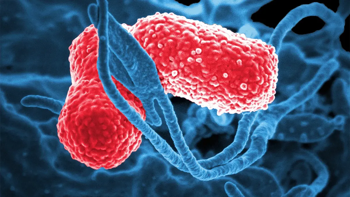 Klebsiella pneumoniae ภาพจาก CDC
