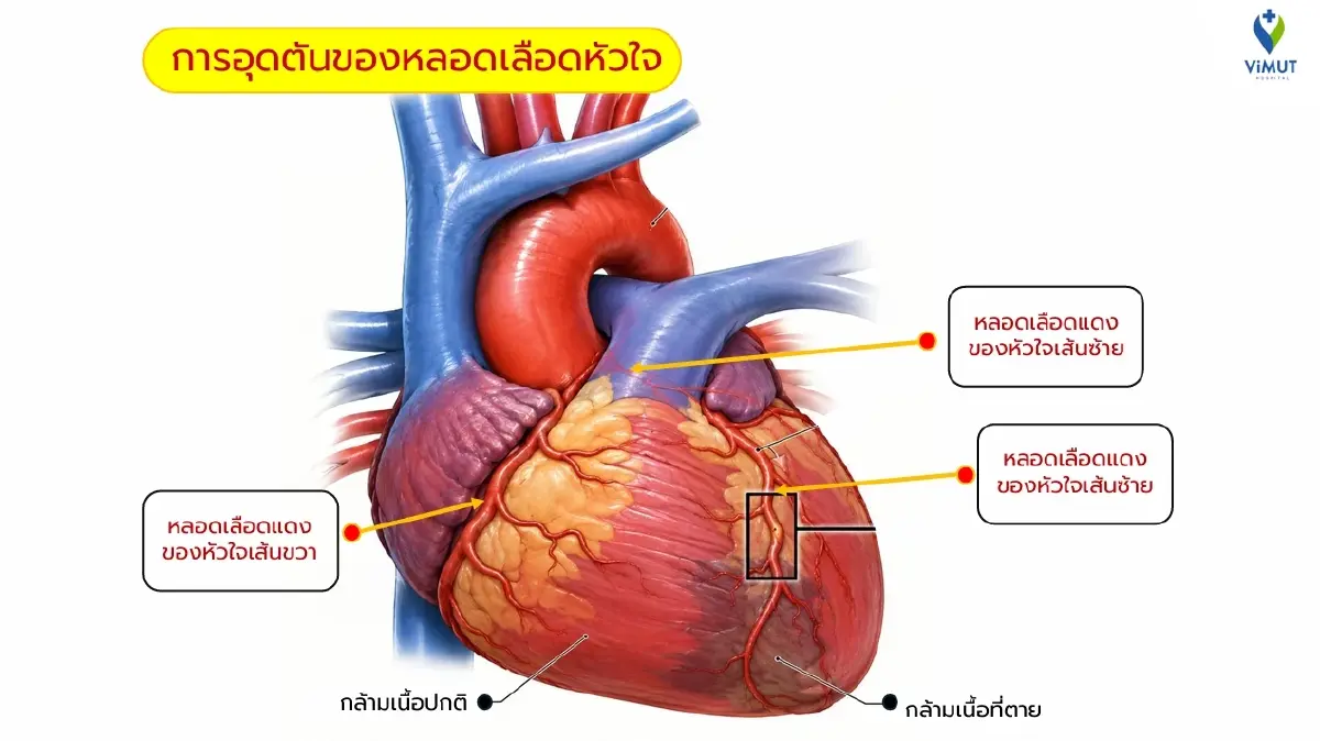 โรคหัวใจอาจไม่ได้เริ่มที่หัวใจ เปิด “5 ตัวเลขสุขภาพ” สัญญาณเตือนภัยเงียบ