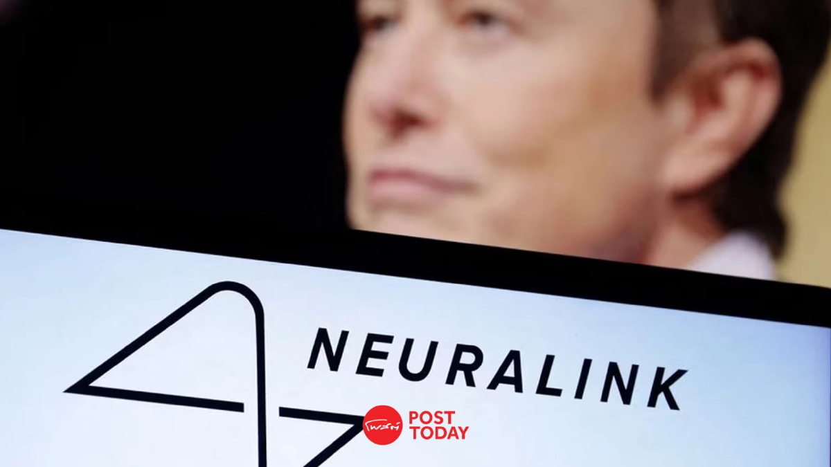 Neuralink บริษัทด้านการแพทย์ของ Elon Musk ถูกร้องเรียนเรื่องเชื้อปนเปื้อน Neuralink บริษัทด้านการแพทย์ของ Elon Musk ถูกร้องเรียนเรื่องเชื้อปนเปื้อน