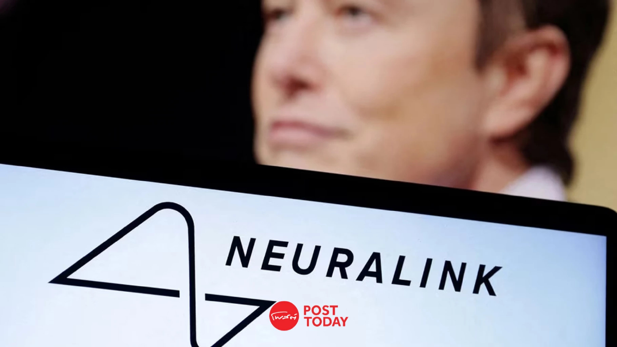 Musk เฟ้นหาพันธมิตรทดลองเทคโนโลยีปลูกถ่ายสมอง Musk เฟ้นหาพันธมิตรทดลองเทคโนโลยีปลูกถ่ายสมอง