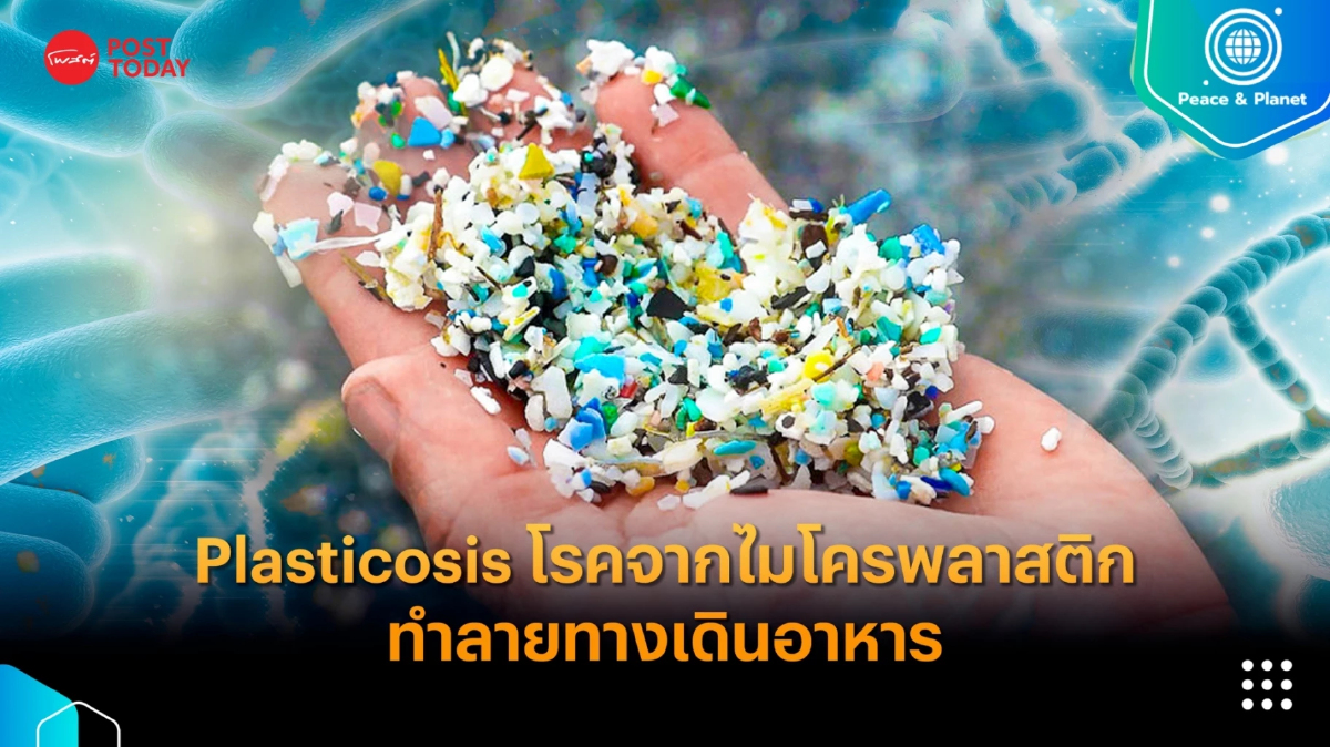 Plasticosis โรคร้ายจากไมโครพลาสติกทำลายทางเดินอาหาร Plasticosis โรคร้ายจากไมโครพลาสติกทำลายทางเดินอาหาร