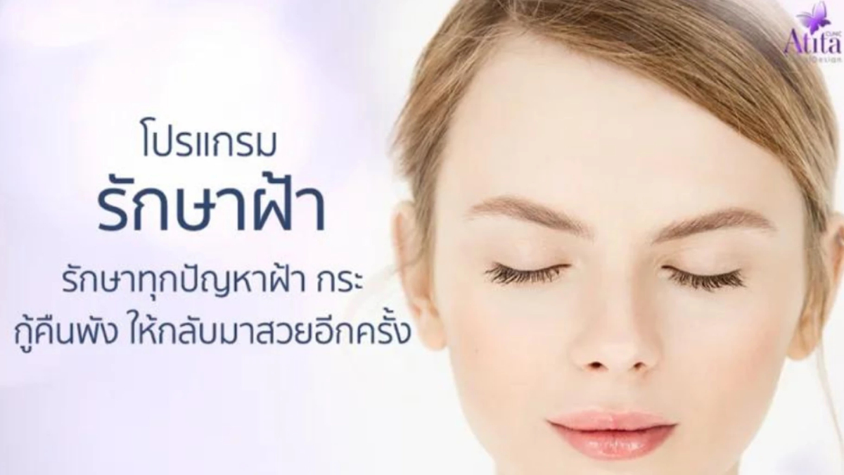 บอกต่อวิธีรักษากระ คืนหน้าใสมั่นใจกว่าเดิม บอกต่อวิธีรักษากระ คืนหน้าใสมั่นใจกว่าเดิม