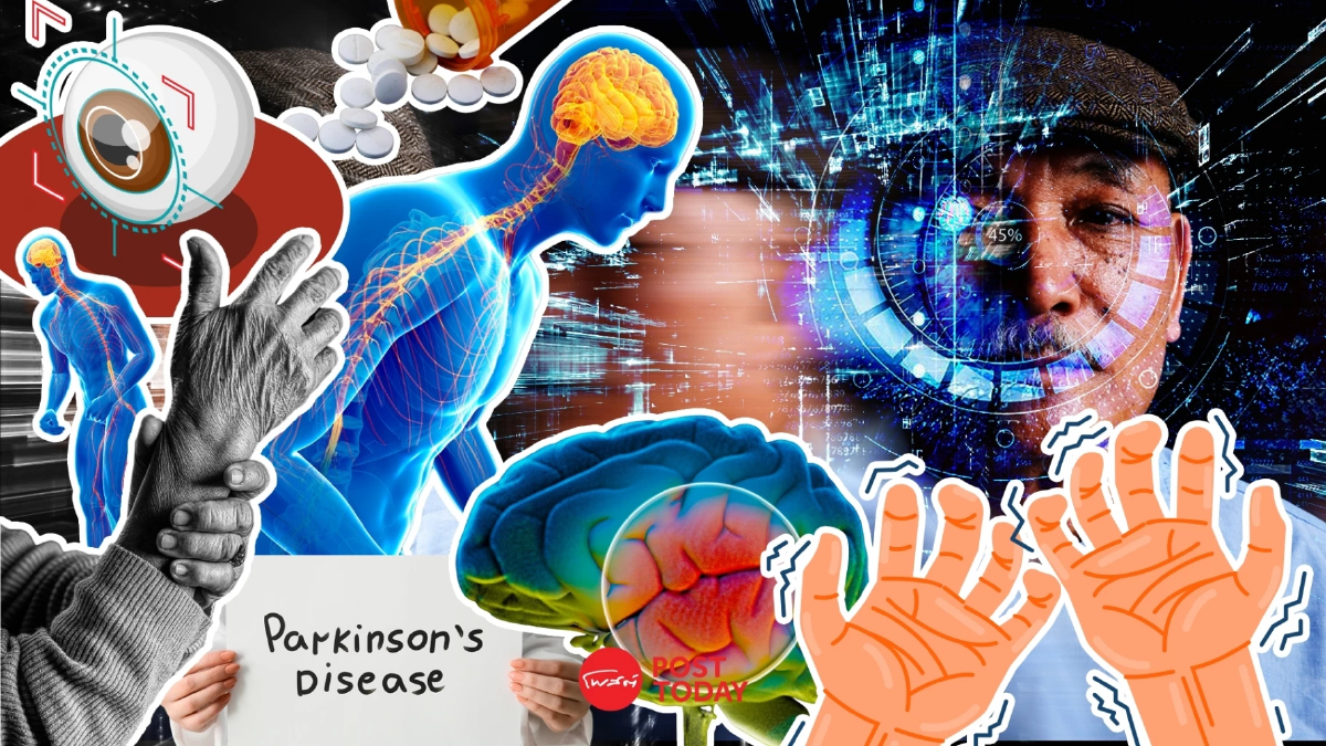 AI ตรวจจับสัญญาณพาร์กินสัน สามารถรู้ตัวล่วงหน้าได้ถึง 7 ปี AI ตรวจจับสัญญาณพาร์กินสัน สามารถรู้ตัวล่วงหน้าได้ถึง 7 ปี