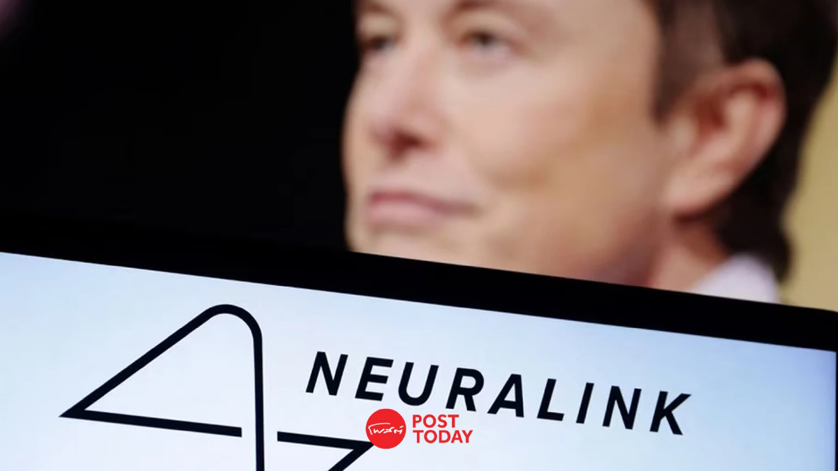 Neuralink เตรียมทดลองปลูกถ่ายสมองในมนุษย์เป็นครั้งแรก Neuralink เตรียมทดลองปลูกถ่ายสมองในมนุษย์เป็นครั้งแรก