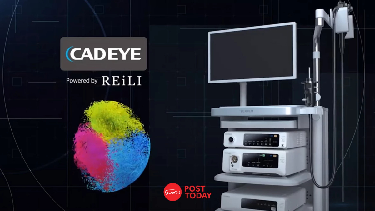 พบกับ CAD EYE นวัตกรรม AI ส่องกล้อง แม่นยำขึ้นตรวจหามะเร็งทางเดินอาหาร พบกับ CAD EYE นวัตกรรม AI ส่องกล้อง แม่นยำขึ้นตรวจหามะเร็งทางเดินอาหาร