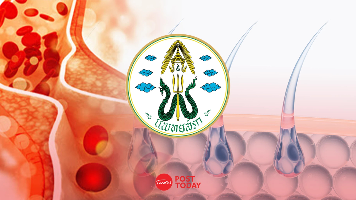แพทยสภาแถลง 'เก็บสเต็มเซลล์จากรก' และ 'สเต็มเซลล์รากผม' ไม่จำเป็น ไม่แนะนำ! แพทยสภาแถลง 'เก็บสเต็มเซลล์จากรก' และ 'สเต็มเซลล์รากผม' ไม่จำเป็น ไม่แนะนำ!