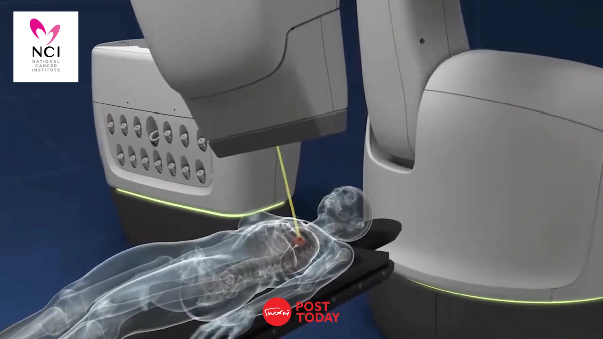 CyberKnife! นวัตกรรมรักษามะเร็งโดยไม่ต้องผ่าตัด ที่ประเทศไทยนำมาใช้แล้ว! CyberKnife! นวัตกรรมรักษามะเร็งโดยไม่ต้องผ่าตัด ที่ประเทศไทยนำมาใช้แล้ว!