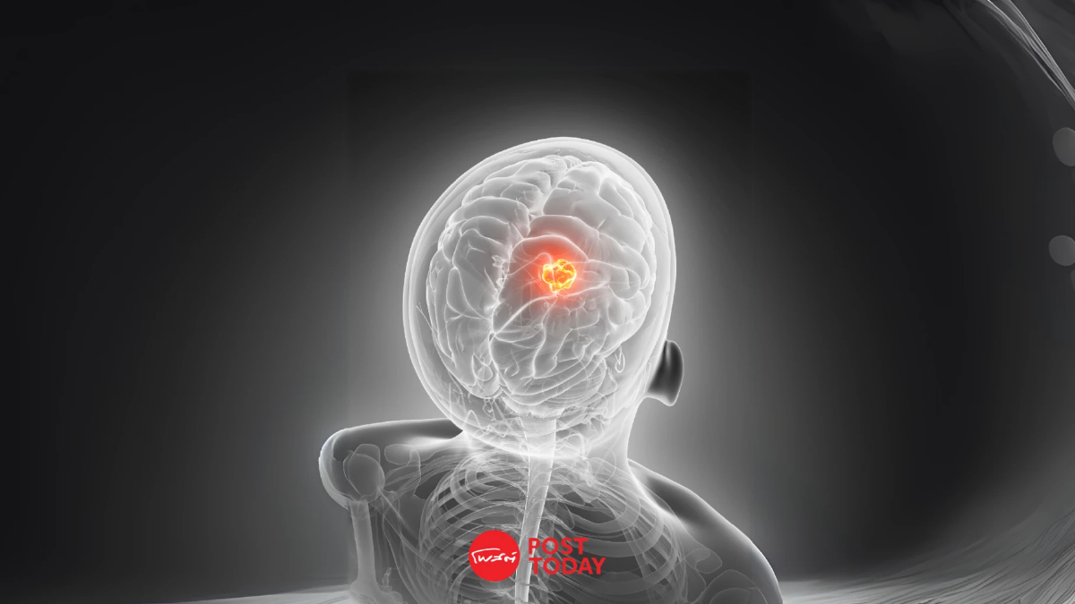 มช.เจ๋ง! พัฒนา AI วิเคราะห์ภาพ MRI มะเร็งสมอง แม่นยำขึ้น 97% มช.เจ๋ง! พัฒนา AI วิเคราะห์ภาพ MRI มะเร็งสมอง แม่นยำขึ้น 97%