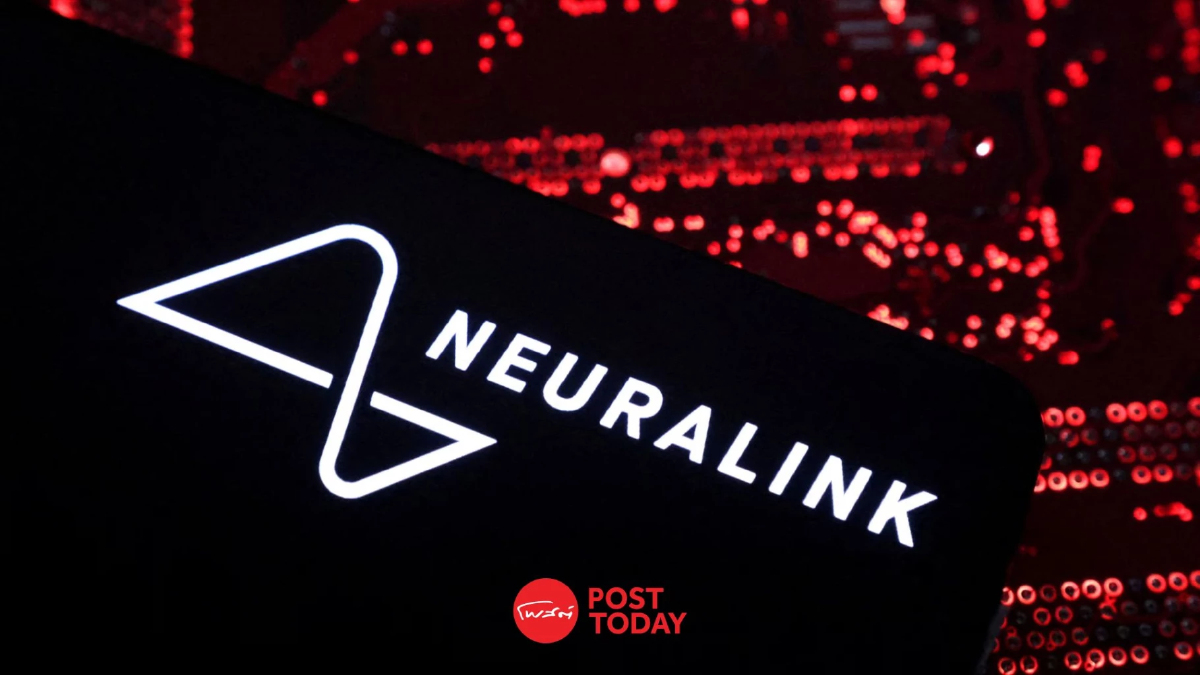 Neuralink กางแผนยักษ์! ตั้งเป้าฝังชิปในสมอง 2 หมื่นคนต่อปี Neuralink กางแผนยักษ์! ตั้งเป้าฝังชิปในสมอง 2 หมื่นคนต่อปี