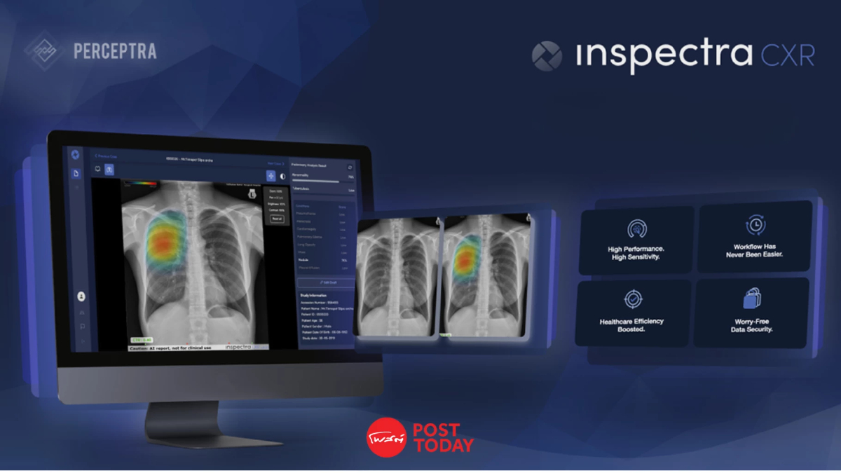 ชู ‘AI Chest X-ray เพิ่มประสิทธิภาพตรวจคัดกรองวัณโรค - มะเร็งปอด' ชู ‘AI Chest X-ray เพิ่มประสิทธิภาพตรวจคัดกรองวัณโรค - มะเร็งปอด'