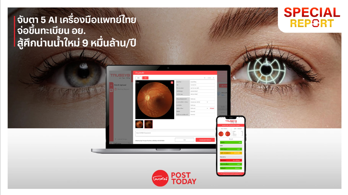 กางโรดแมป! ดัน 5 AI เครื่องมือแพทย์สัญชาติไทย ขึ้นทะเบียน อย. ชิงเค้ก 9 หมื่นล้าน! กางโรดแมป! ดัน 5 AI เครื่องมือแพทย์สัญชาติไทย ขึ้นทะเบียน อย. ชิงเค้ก 9 หมื่นล้าน!