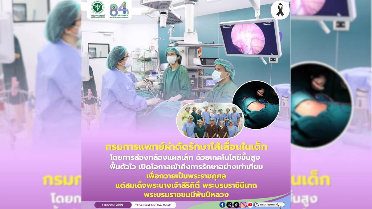 กรมการแพทย์โชว์นวัตกรรม "ผ่าตัดไส้เลื่อนเด็กส่องกล้องแผลเล็ก" ฟื้นตัวไว-ปลอดภัยสูง เดินหน้าขยายโอกาสการรักษาที่เท่าเทียมเพื่อถวายเป็นพระราชกุศล กรมการแพทย์โชว์นวัตกรรม "ผ่าตัดไส้เลื่อนเด็กส่องกล้องแผลเล็ก" ฟื้นตัวไว-ปลอดภัยสูง เดินหน้าขยายโอกาสการรักษาที่เท่าเทียมเพื่อถวายเป็นพระราชกุศล