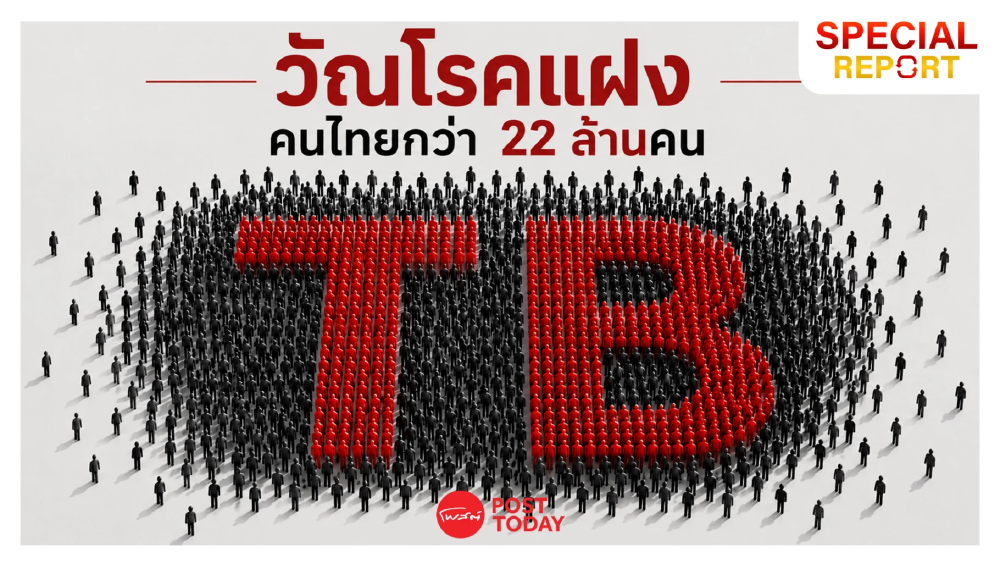“วัณโรค” แฝงอยู่ในตัวคนไทยราว 22 ล้านคนโดยไม่รู้ตัว!