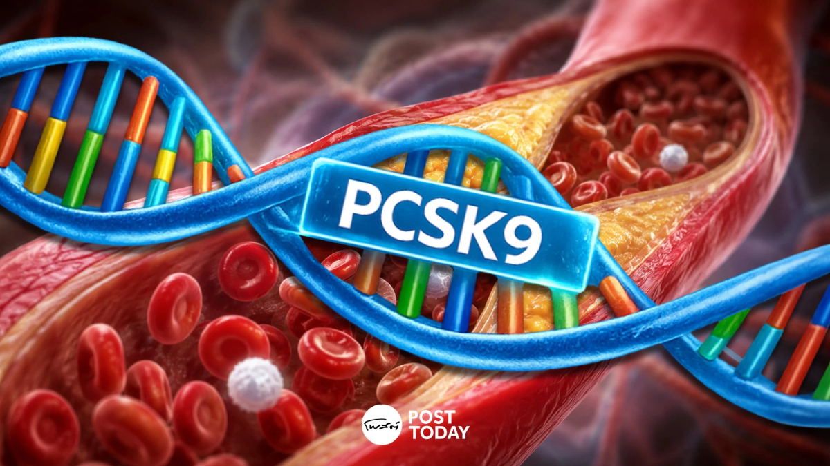 "ไขมันในเลือดสูงได้ไง?" คำตอบอาจอยู่ที่ "ยีน PCSK9" "ไขมันในเลือดสูงได้ไง?" คำตอบอาจอยู่ที่ "ยีน PCSK9"