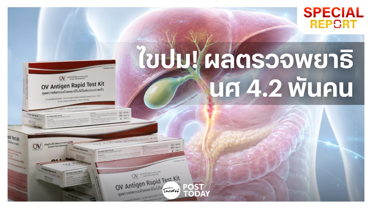ไขปม! ผลตรวจพยาธิ 4,233 นิสิต มมส. ทำไมยังต้องตรวจยืนยันซ้ำ หรือ มีอะไรมากกว่าที่เห็น? ไขปม! ผลตรวจพยาธิ 4,233 นิสิต มมส. ทำไมยังต้องตรวจยืนยันซ้ำ หรือ มีอะไรมากกว่าที่เห็น?