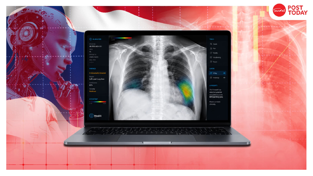 เปิด 7 ธุรกิจดาวรุ่ง รับ Medical Hub รอบใหม่ จาก Clinical Trial ถึง Medical AI เปิด 7 ธุรกิจดาวรุ่ง รับ Medical Hub รอบใหม่ จาก Clinical Trial ถึง Medical AI