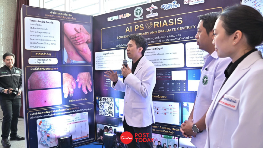สธ.เปิดตัว ”AI Psoriasis" นวัตกรรมอัจฉริยะคัดกรองโรคสะเก็ดเงิน สธ.เปิดตัว ”AI Psoriasis" นวัตกรรมอัจฉริยะคัดกรองโรคสะเก็ดเงิน
