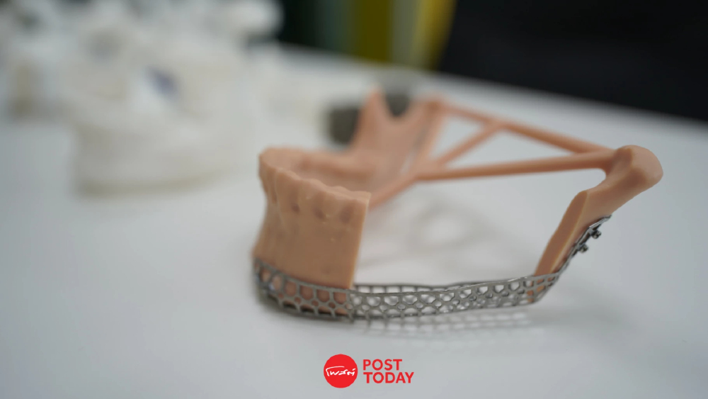 ไทยทำได้! มจธ.จับมือ 3 โรงพยาบาล ดัน AI-3D Printing ผลิตอุปกรณ์แพทย์เฉพาะบุคคล